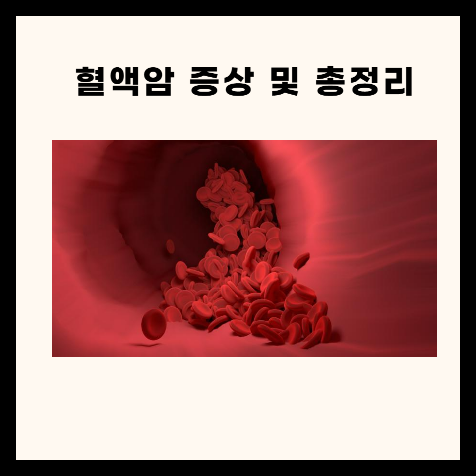 혈액암 : 원인과 증상, 관련 질문 5가지!